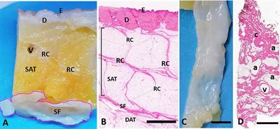 Innervation of human superficial fascia